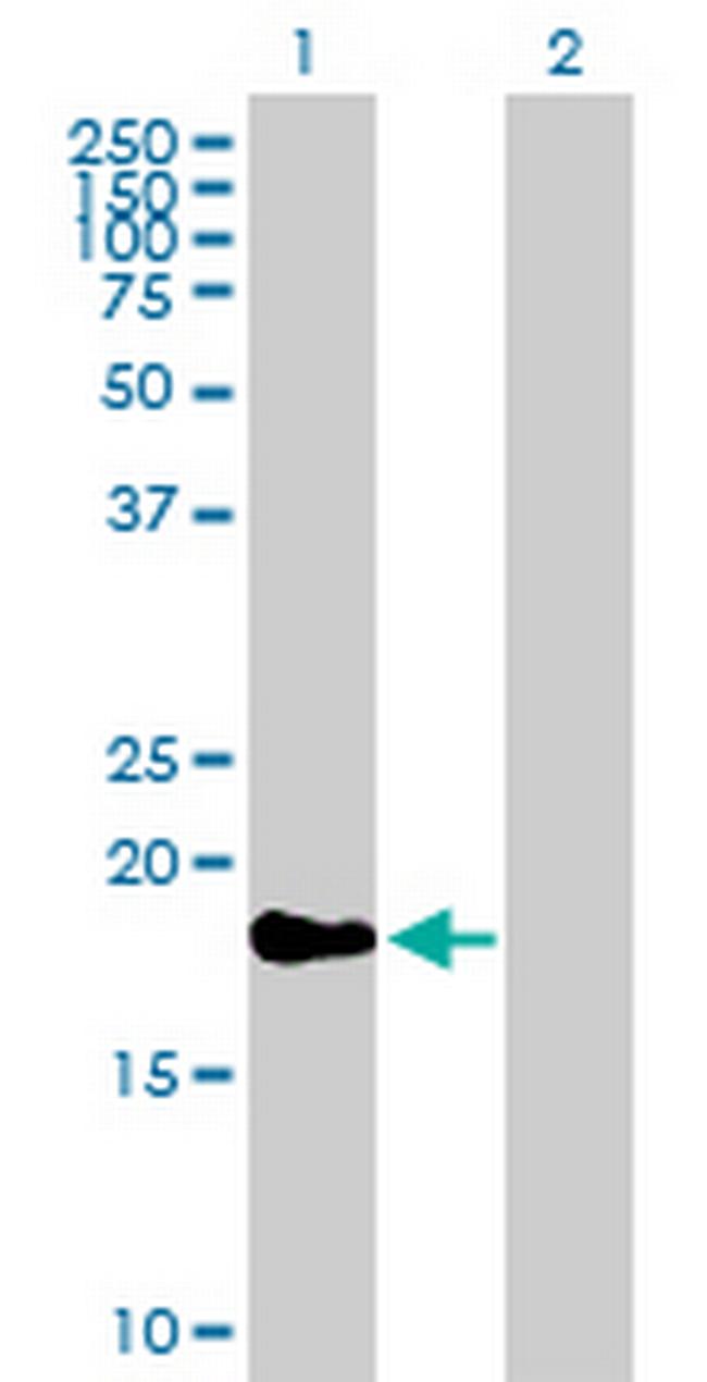 TAF12 Antibody in Western Blot (WB)