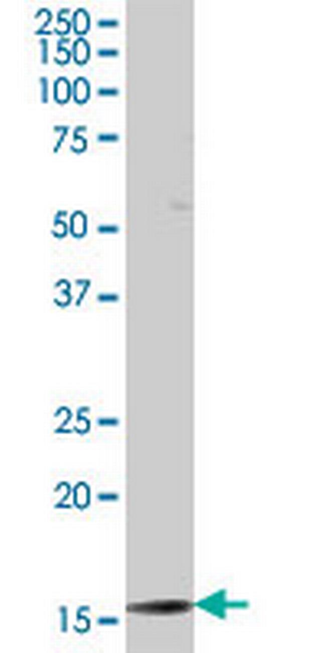 TAF12 Antibody in Western Blot (WB)