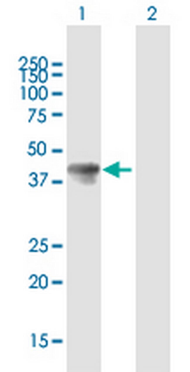 TAL1 Antibody in Western Blot (WB)