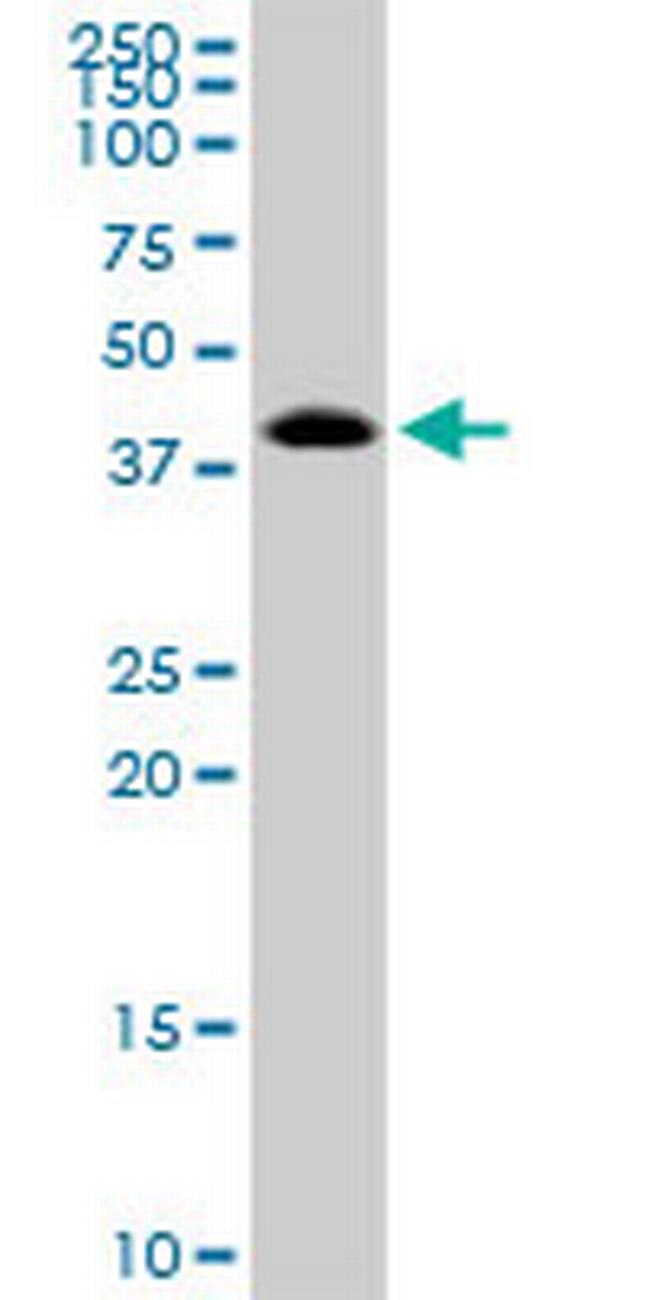 TARBP2 Antibody in Western Blot (WB)