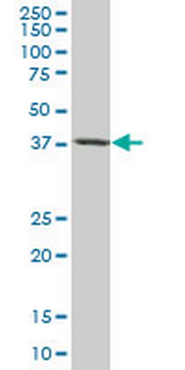 TARBP2 Antibody in Western Blot (WB)