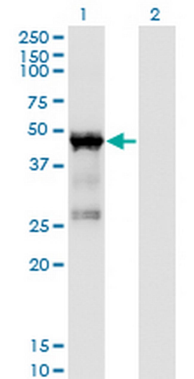 TARBP2 Antibody in Western Blot (WB)