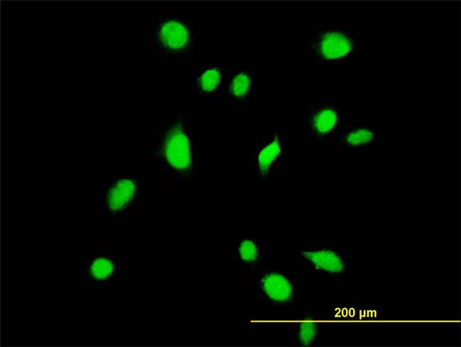 TBX6 Antibody in Immunocytochemistry (ICC/IF)