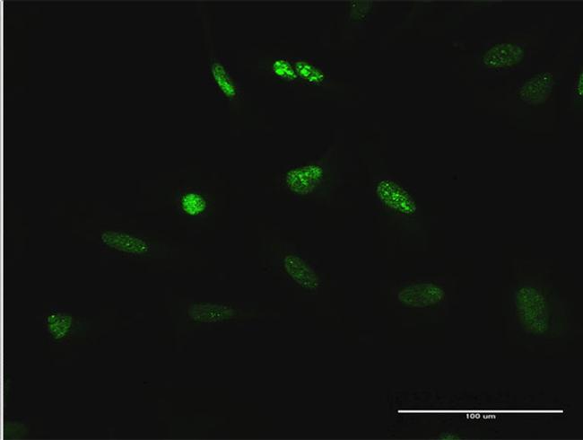 TCEB3 Antibody in Immunocytochemistry (ICC/IF)