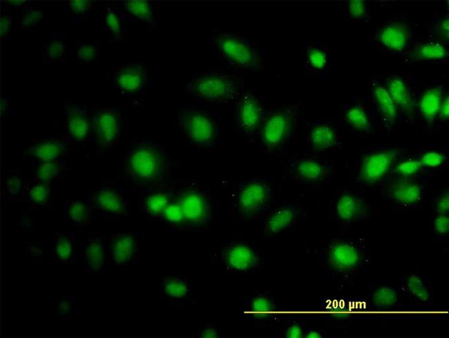 TCEB3 Antibody in Immunocytochemistry (ICC/IF)