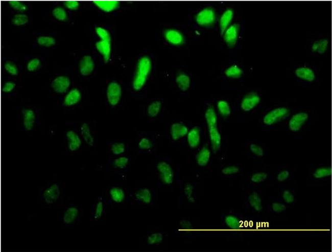 TCF4 Antibody in Immunocytochemistry (ICC/IF)