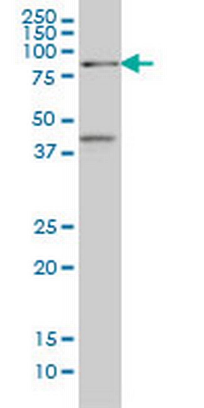 TCF4 Antibody in Western Blot (WB)