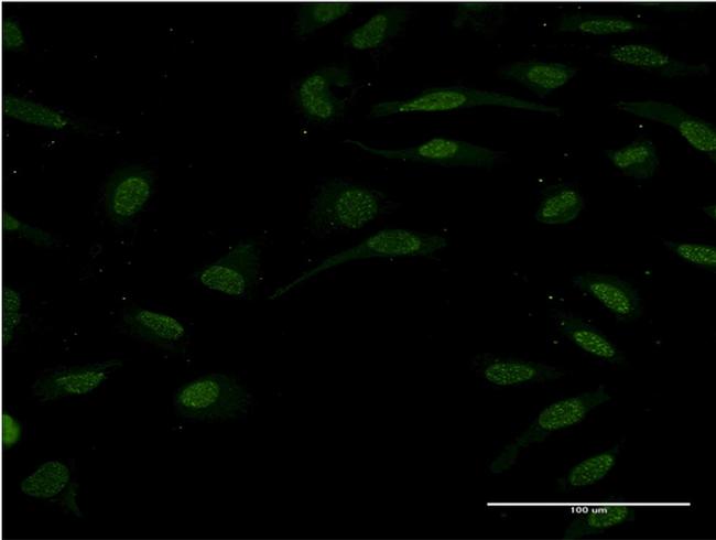 TCF2 Antibody in Immunocytochemistry (ICC/IF)