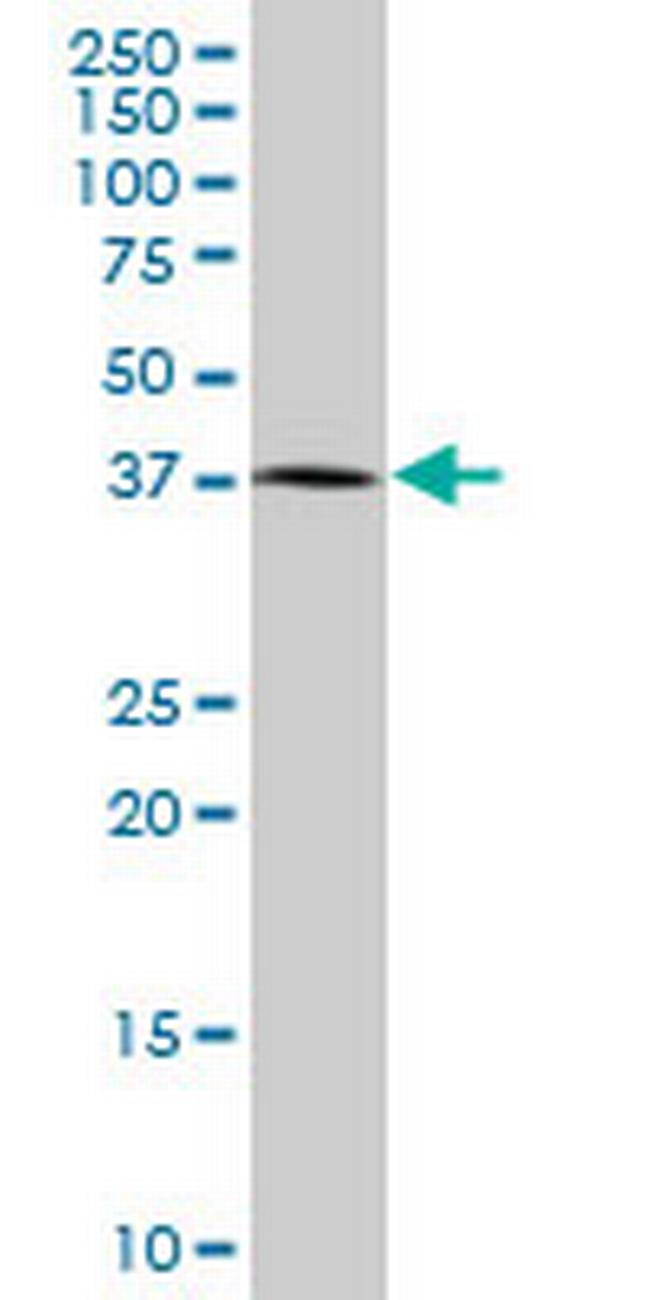 TCF2 Antibody in Western Blot (WB)