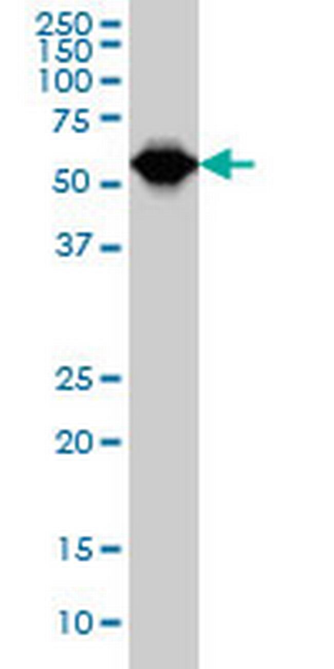 TCF3 Antibody in Western Blot (WB)