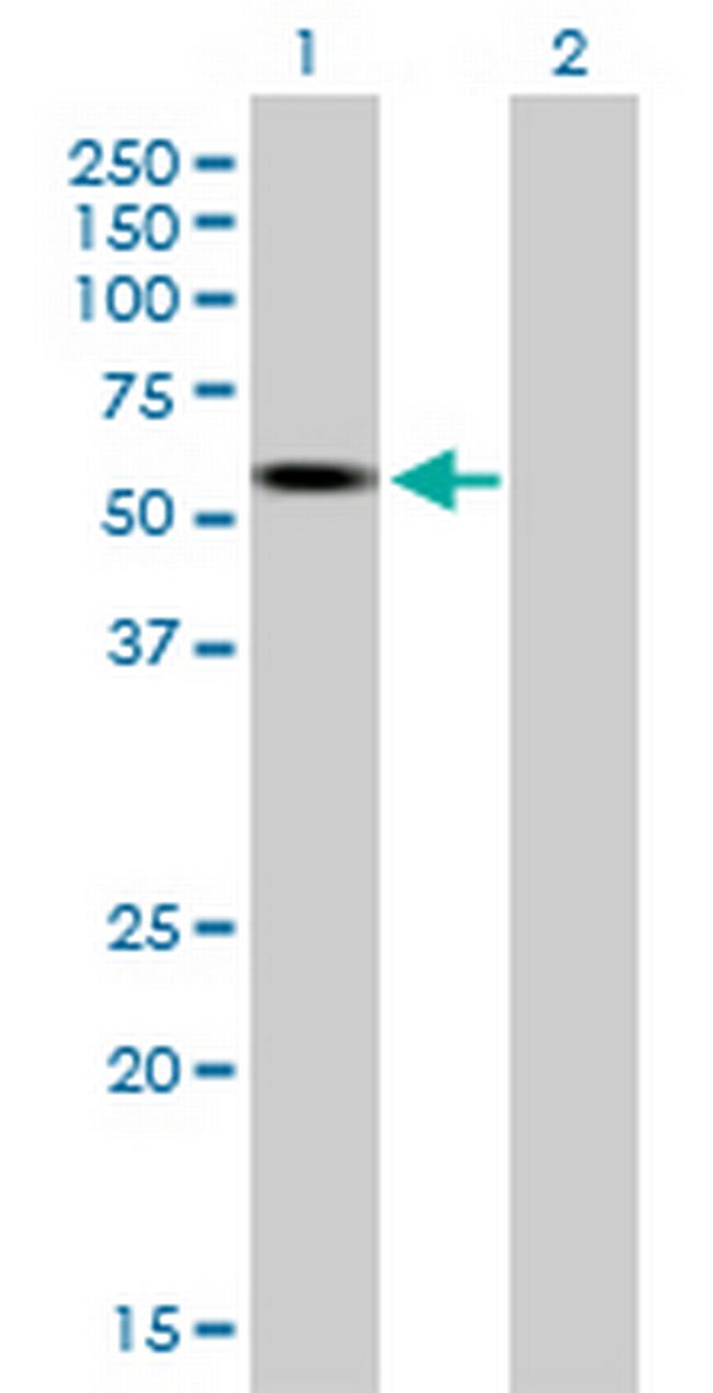 TCF7L2 Antibody in Western Blot (WB)