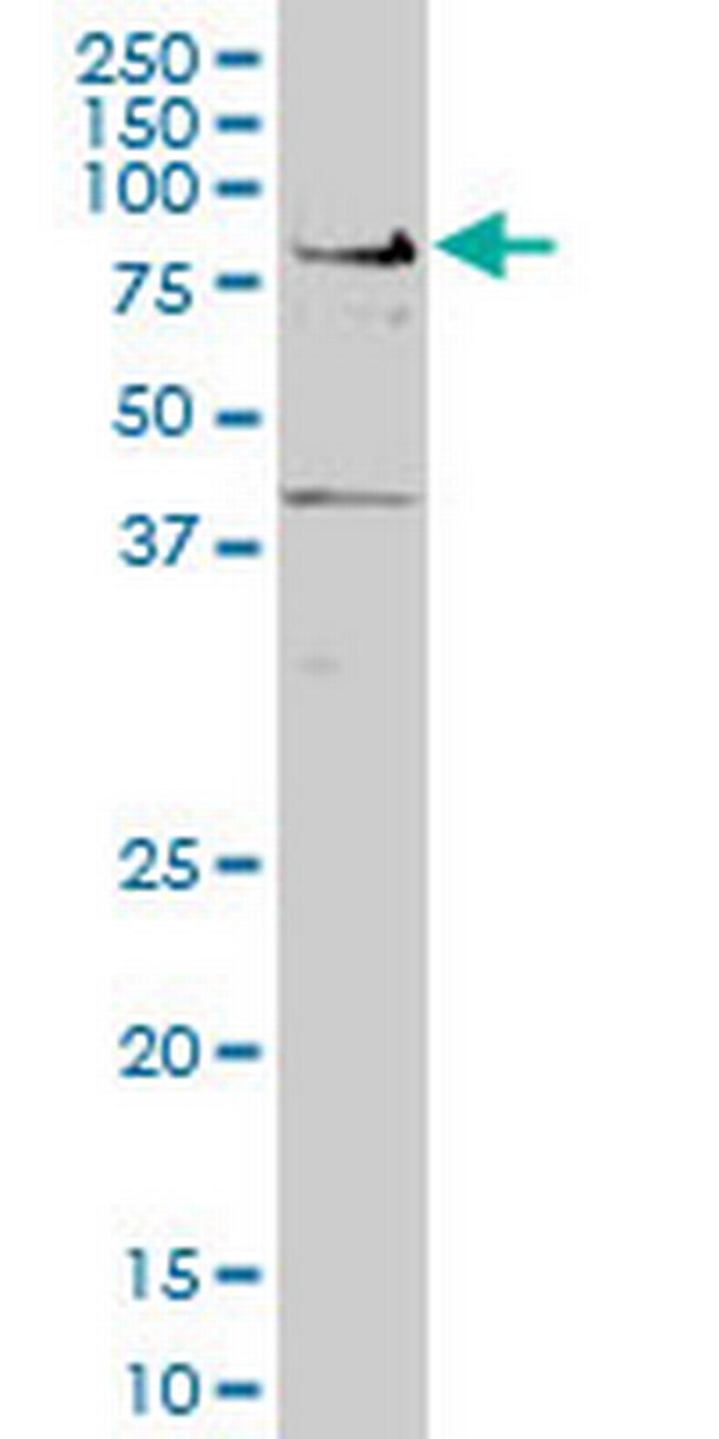 TCF7L2 Antibody in Western Blot (WB)