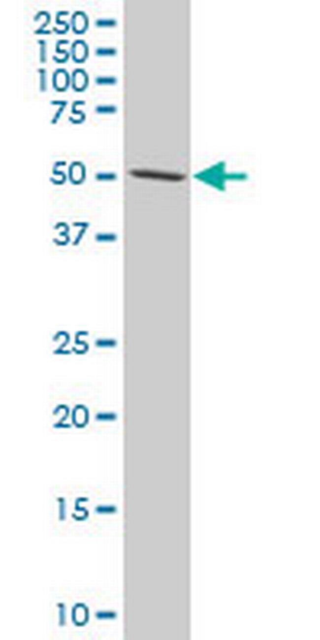 TCF7L2 Antibody in Western Blot (WB)