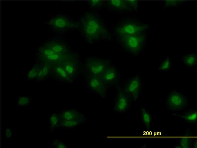 TCF7L2 Antibody in Immunocytochemistry (ICC/IF)