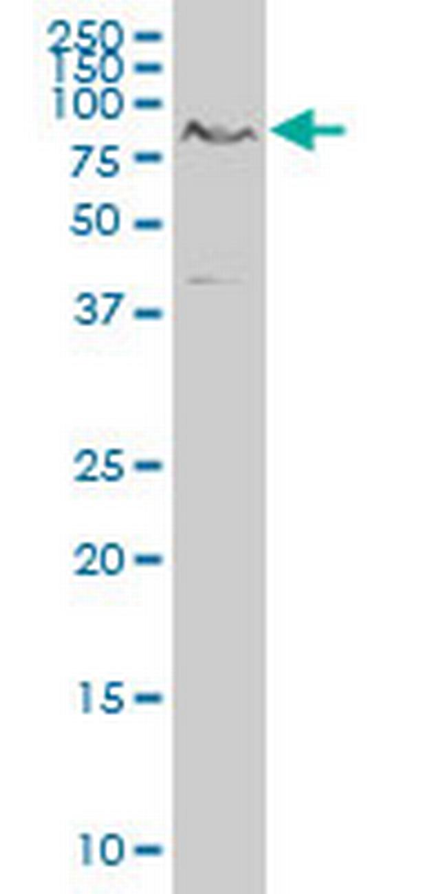 TCF7L2 Antibody in Western Blot (WB)