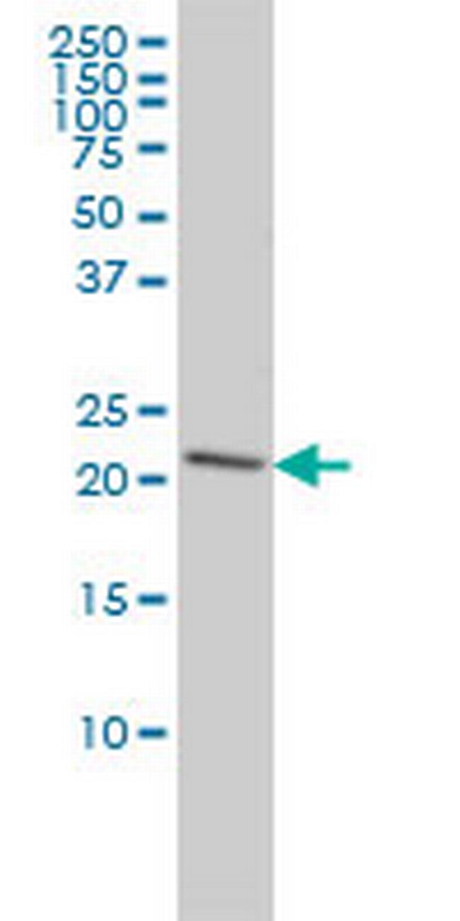 PRDX2 Antibody in Western Blot (WB)