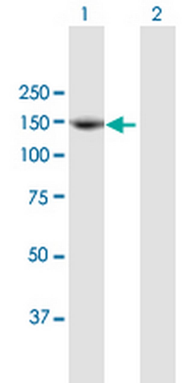 TEK Antibody in Western Blot (WB)