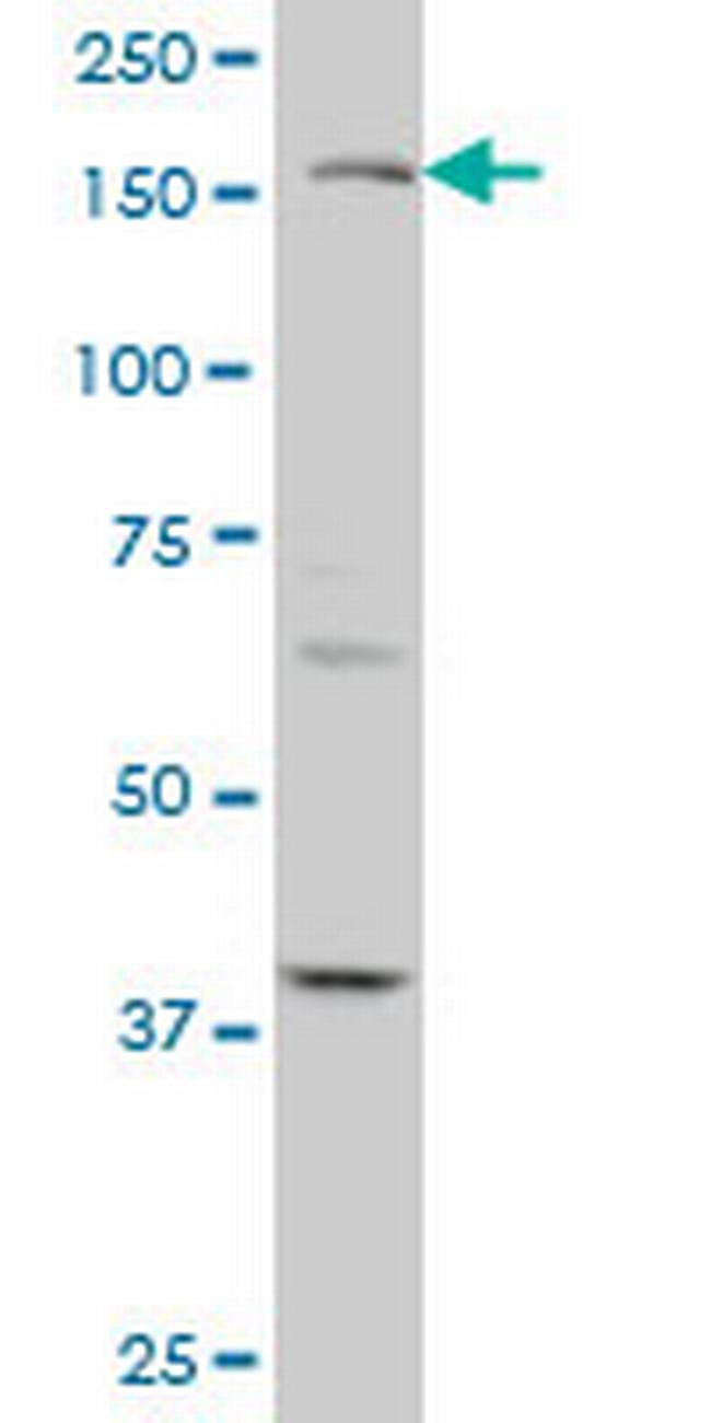 TEK Antibody in Western Blot (WB)