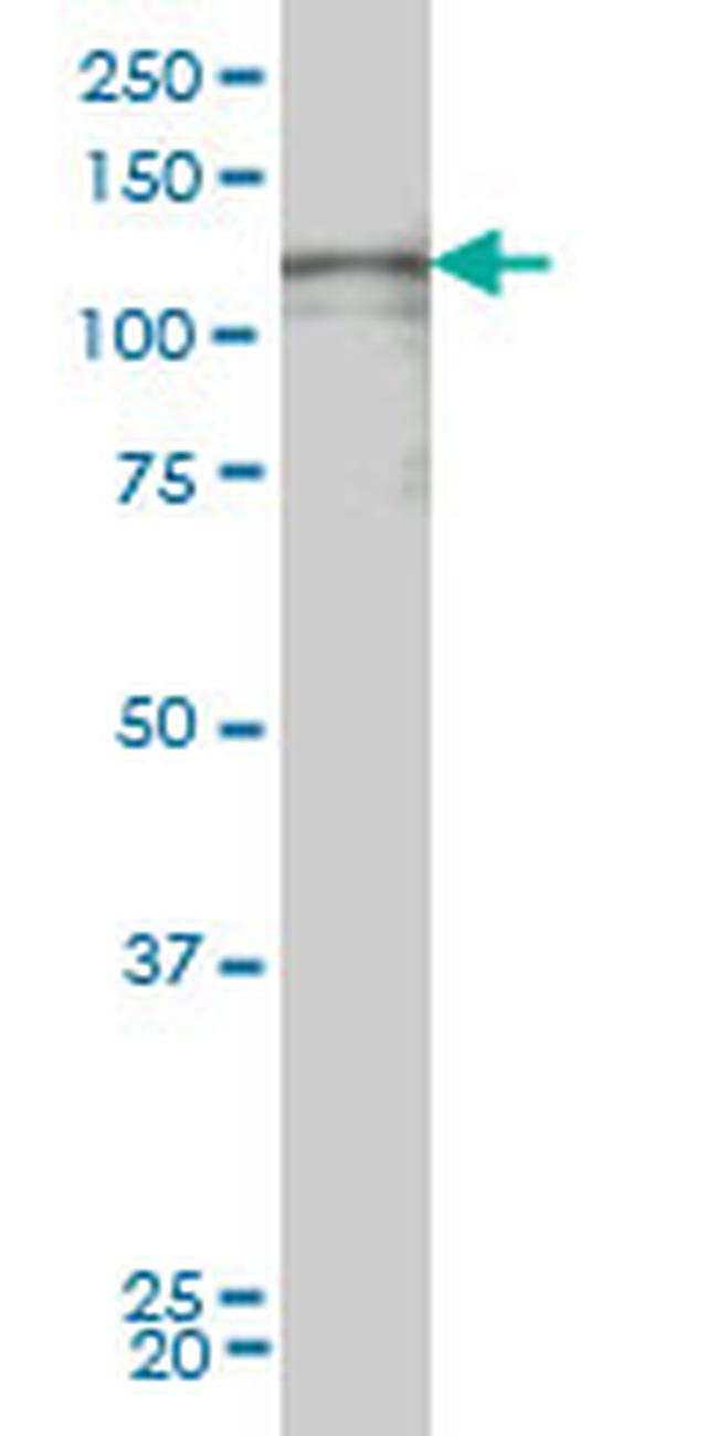 TEK Antibody in Western Blot (WB)