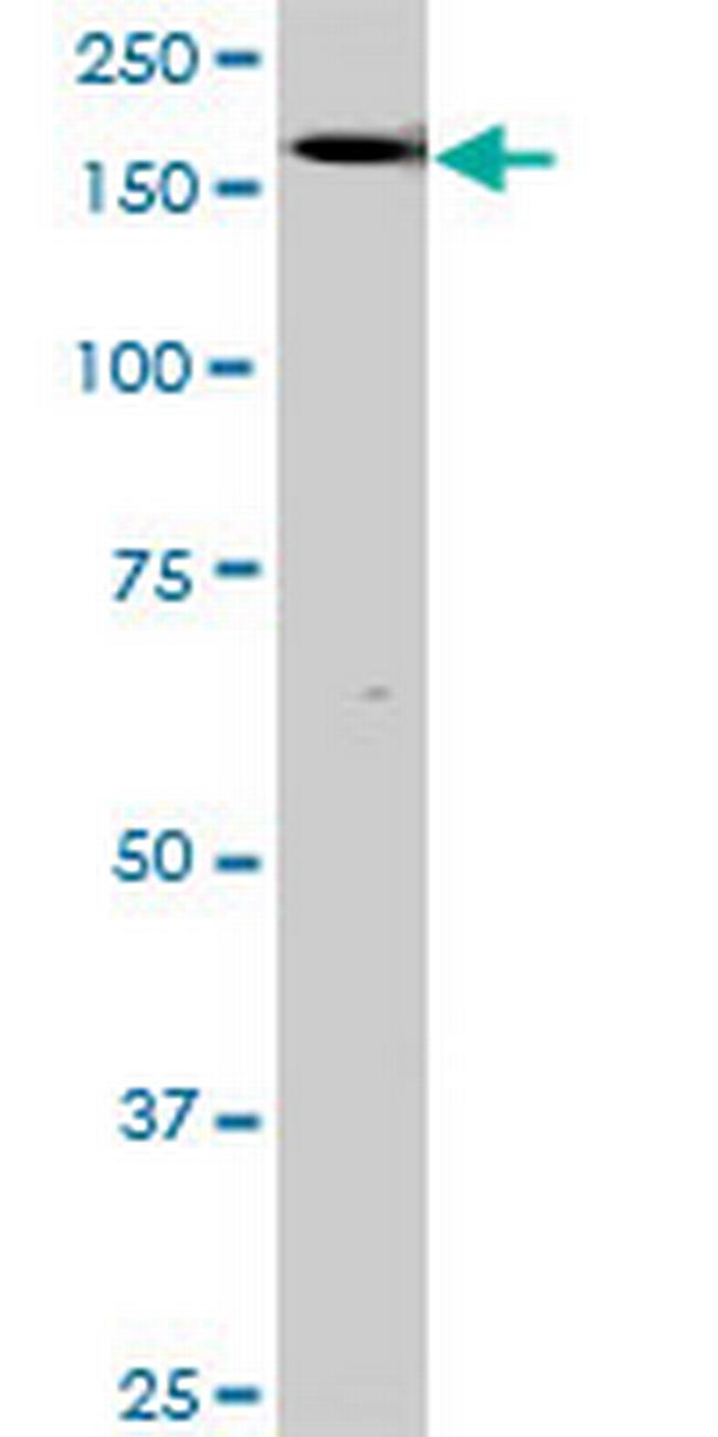 TEK Antibody in Western Blot (WB)