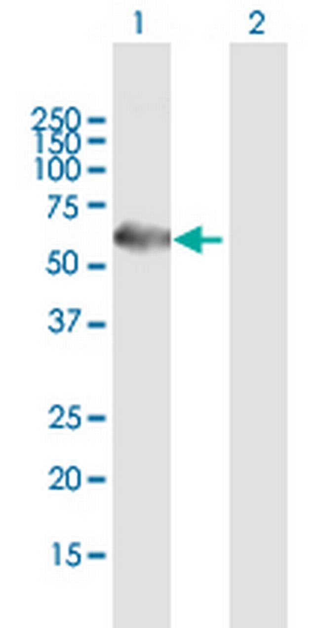 TERF1 Antibody in Western Blot (WB)