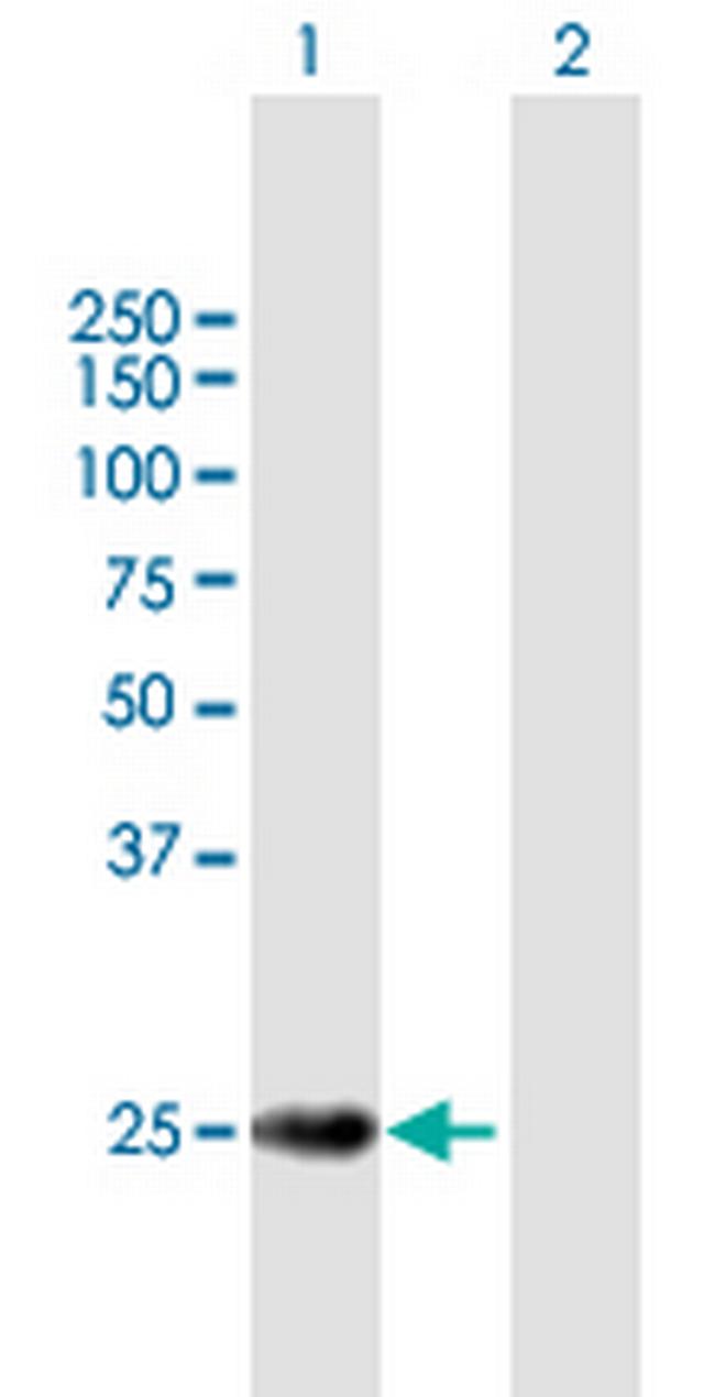 TERF2 Antibody in Western Blot (WB)