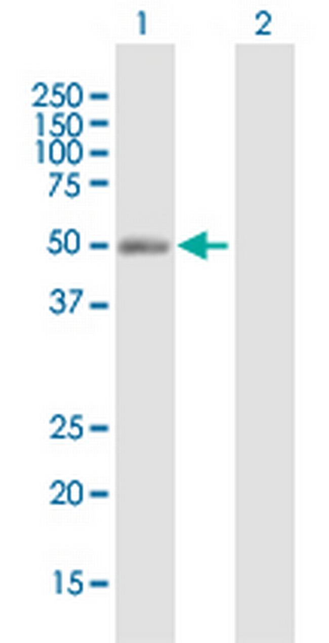 NR2F2 Antibody in Western Blot (WB)