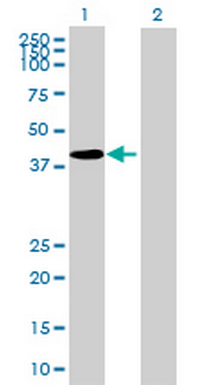 TGFB1I1 Antibody in Western Blot (WB)