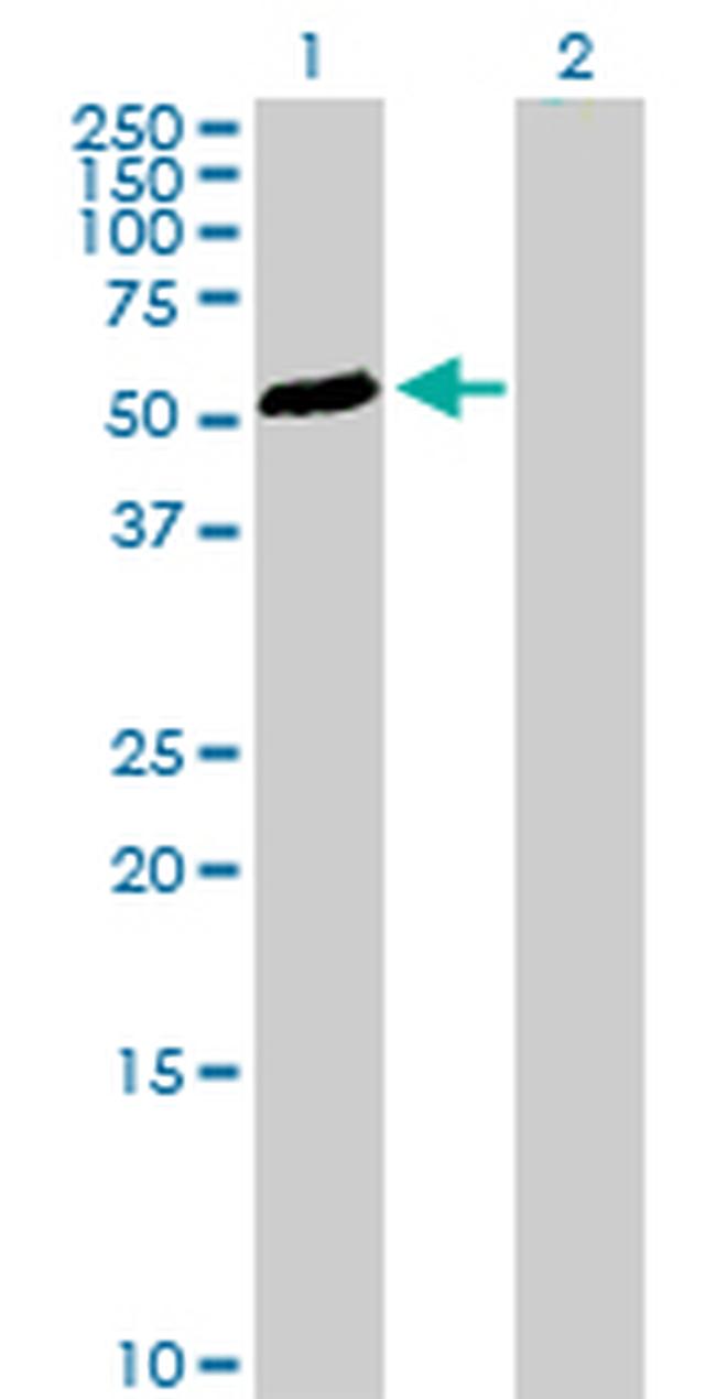 TGFB1I1 Antibody in Western Blot (WB)