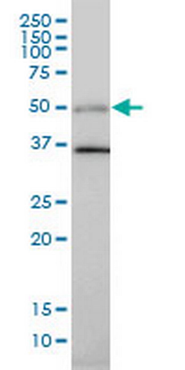 TGFB1I1 Antibody in Western Blot (WB)