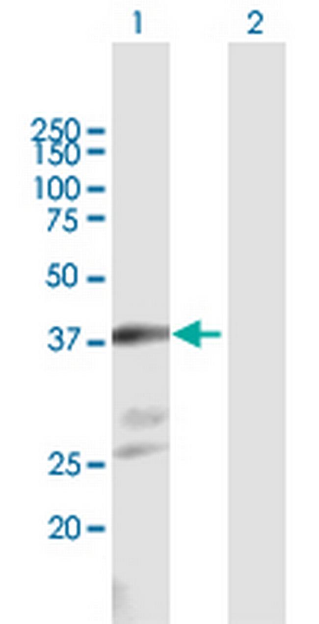 NKX2-1 Antibody in Western Blot (WB)