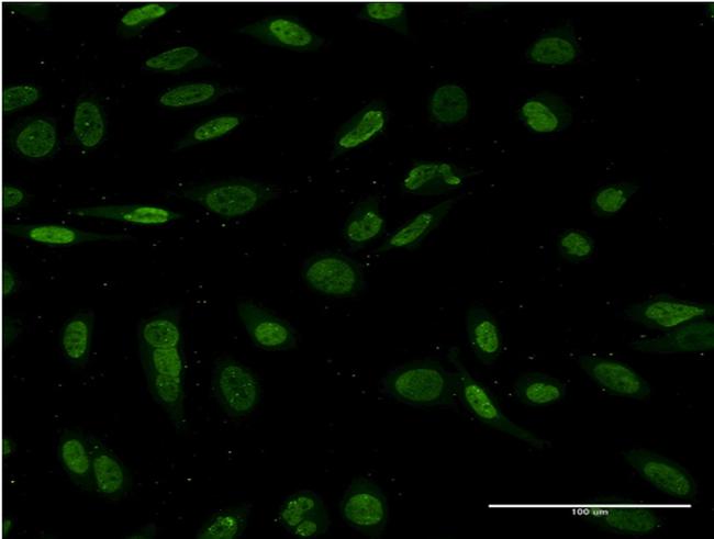 NKX2-1 Antibody in Immunocytochemistry (ICC/IF)