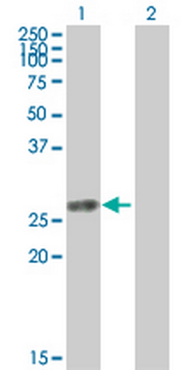 TK1 Antibody in Western Blot (WB)