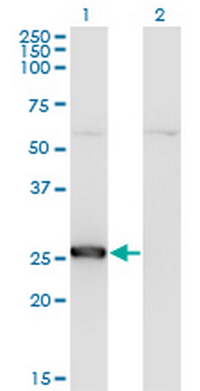 TK1 Antibody in Western Blot (WB)