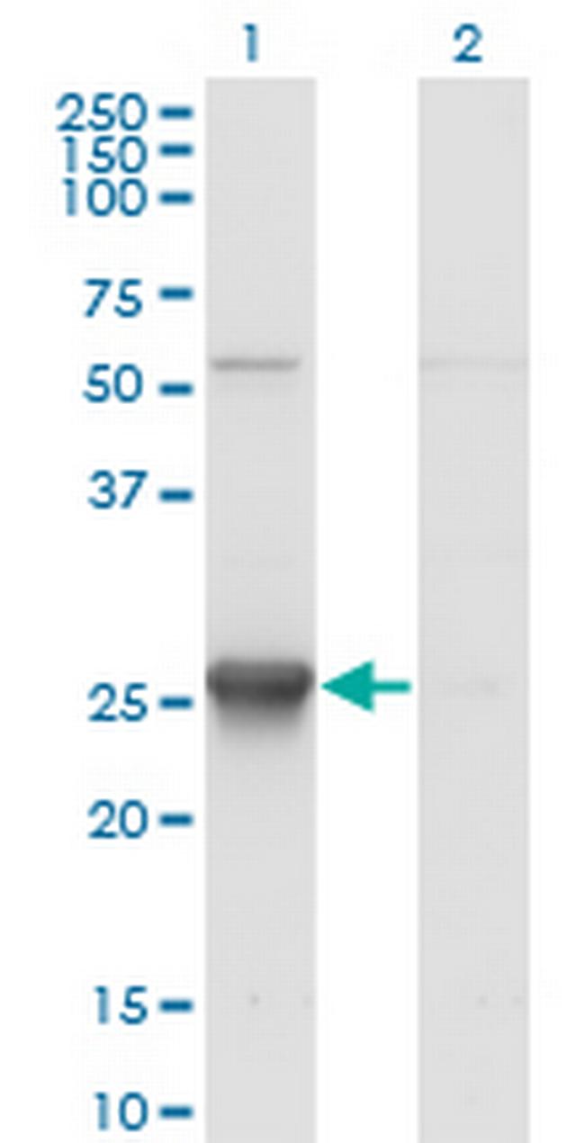 TK1 Antibody in Western Blot (WB)