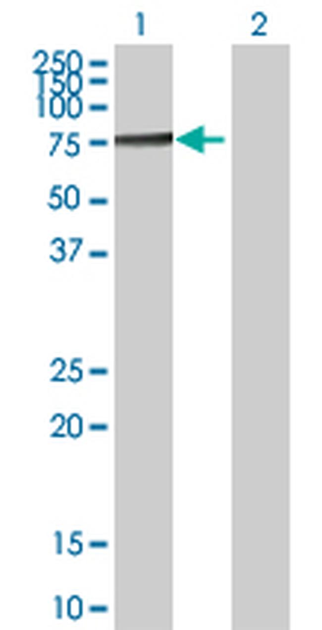 TKT Antibody in Western Blot (WB)