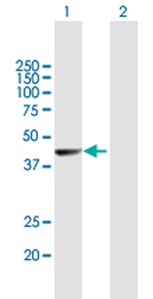 NR2E1 Antibody in Western Blot (WB)