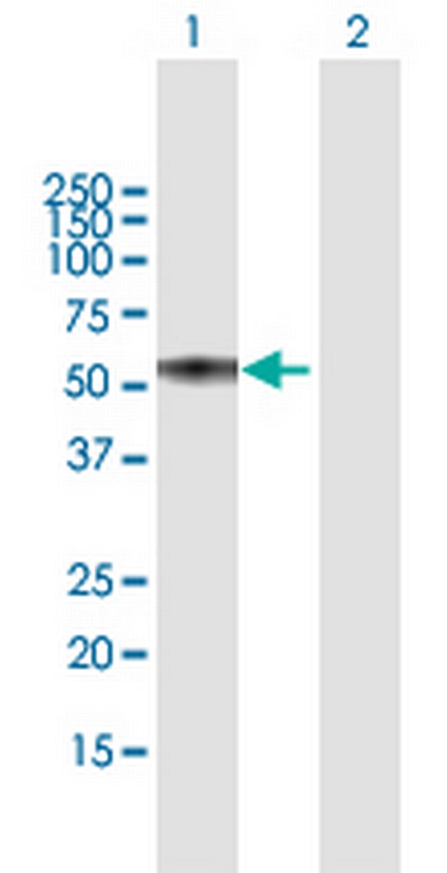 TNFRSF1A Antibody in Western Blot (WB)