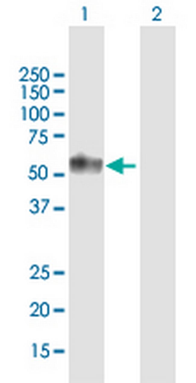 TNFRSF1A Antibody in Western Blot (WB)