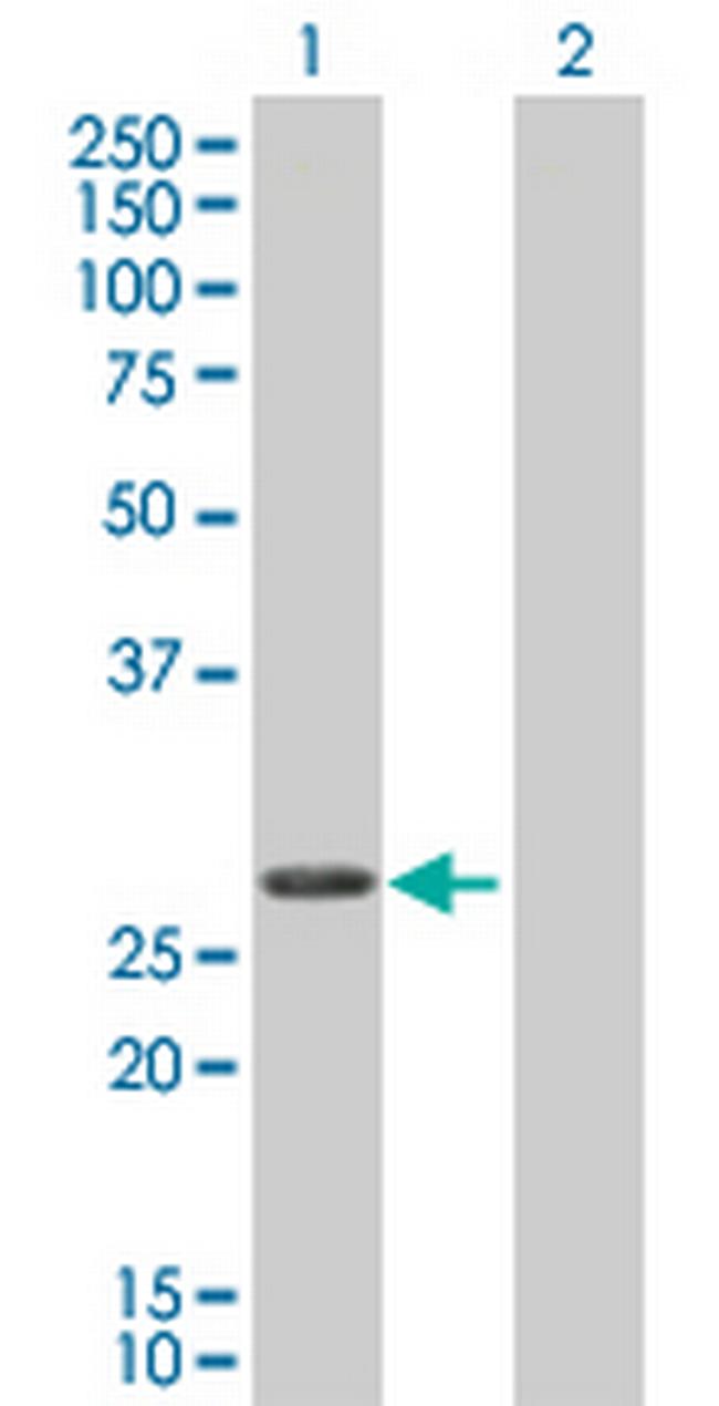 TNNI3 Antibody in Western Blot (WB)