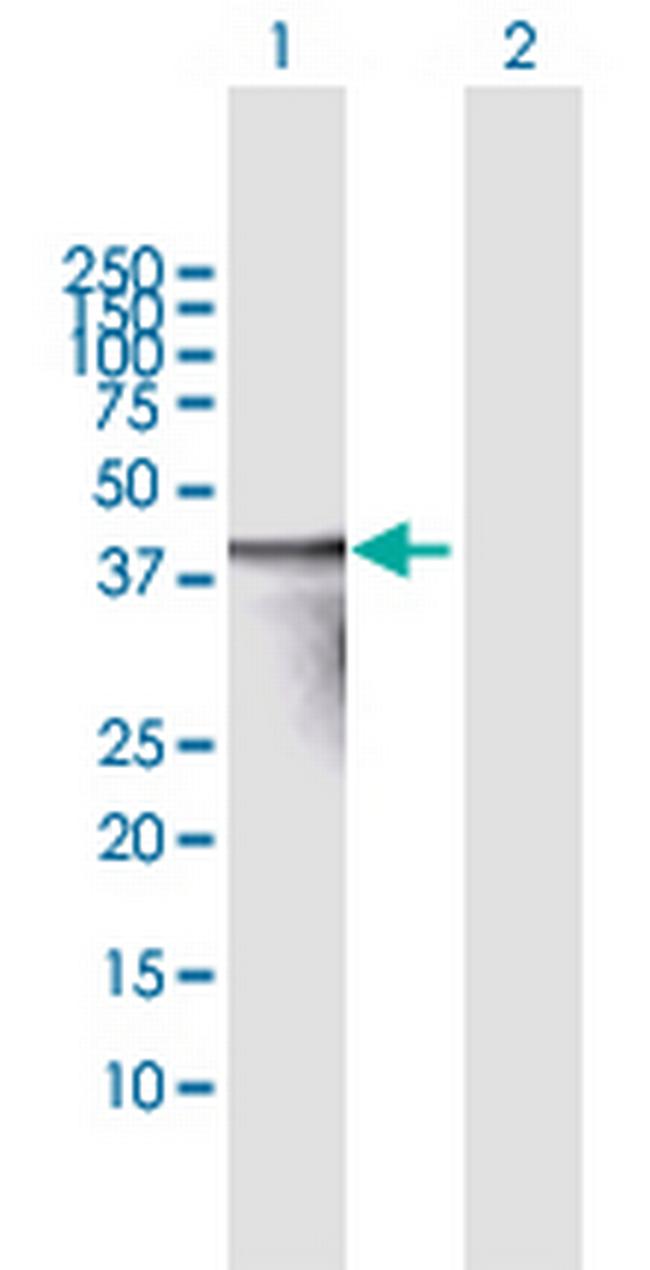 TNNT3 Antibody in Western Blot (WB)