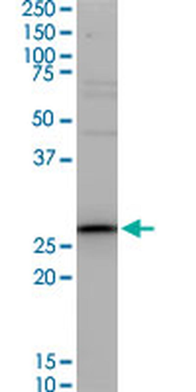 TNNT3 Antibody in Western Blot (WB)