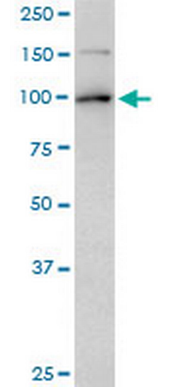 TOP1 Antibody in Western Blot (WB)