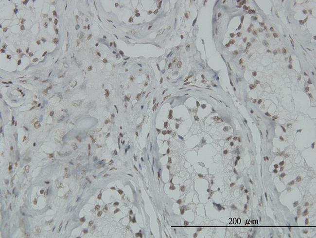 TP53BP2 Antibody in Immunohistochemistry (Paraffin) (IHC (P))