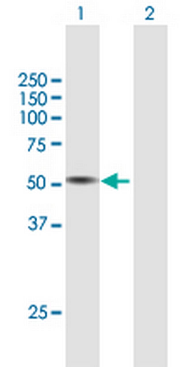 TPH1 Antibody in Western Blot (WB)