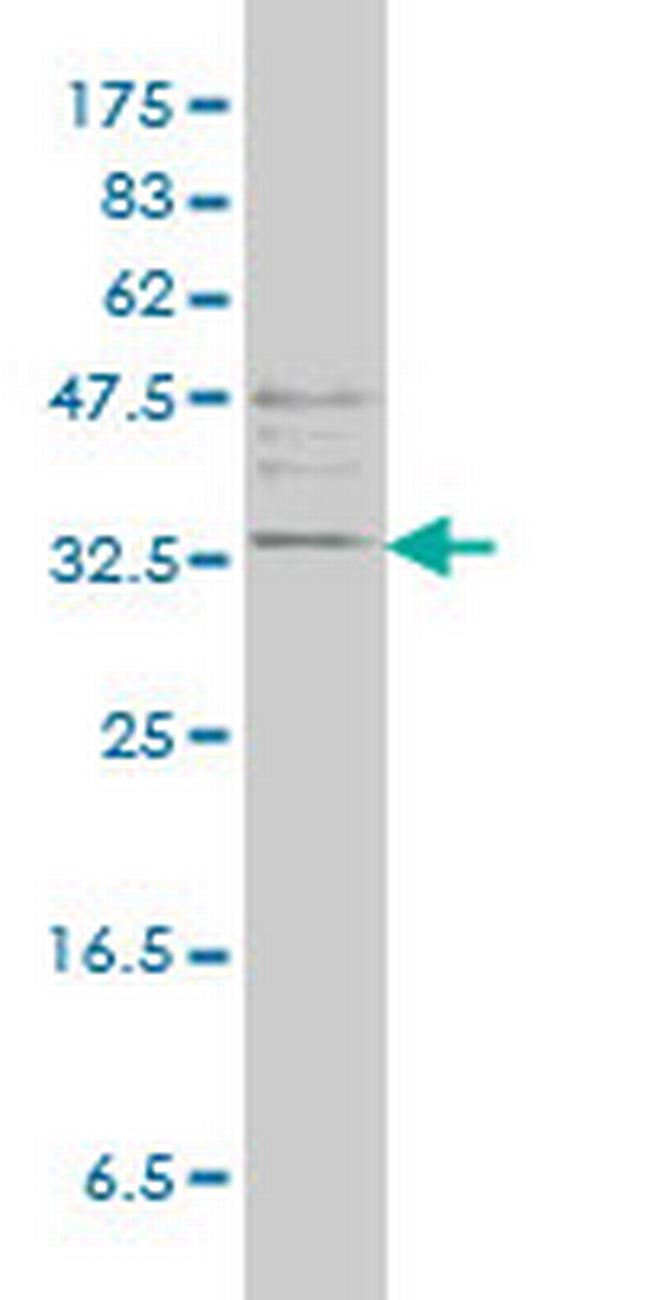 TPSAB1 Antibody in Western Blot (WB)