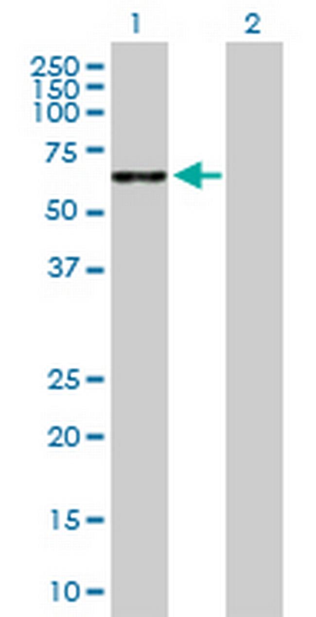 TPTE Antibody in Western Blot (WB)