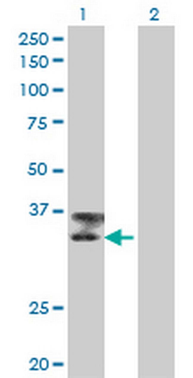 TTN Antibody in Western Blot (WB)