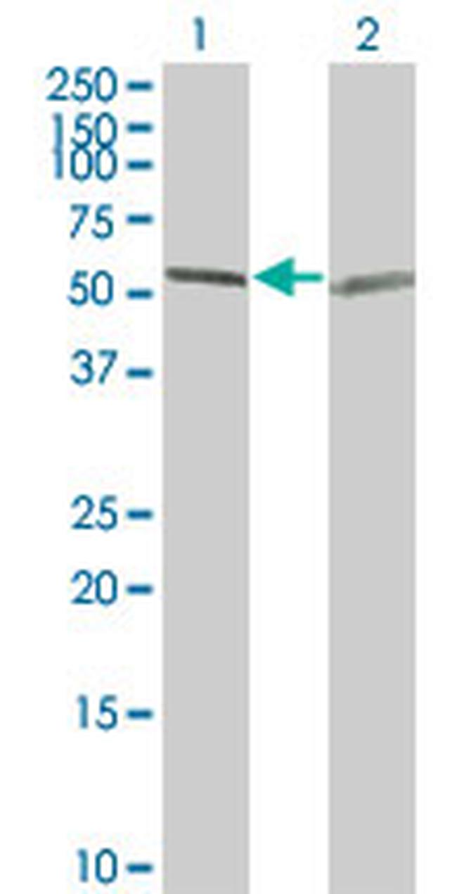 TUBA1 Antibody in Western Blot (WB)