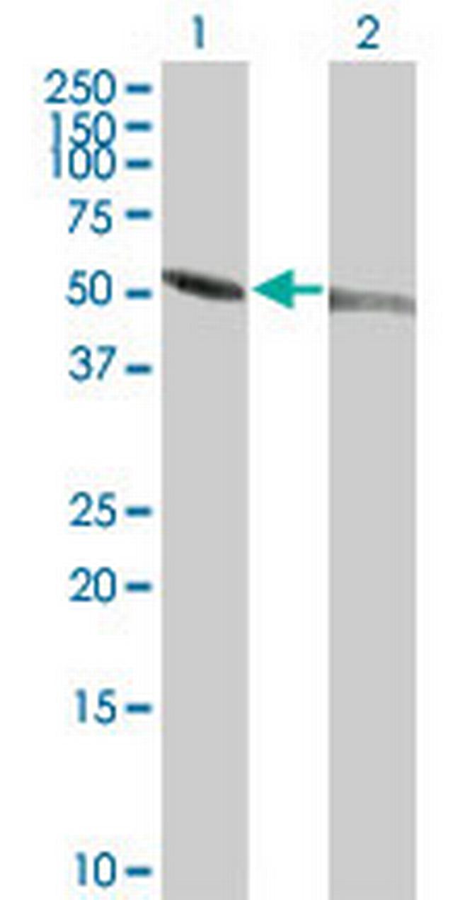 TUBA1 Antibody in Western Blot (WB)